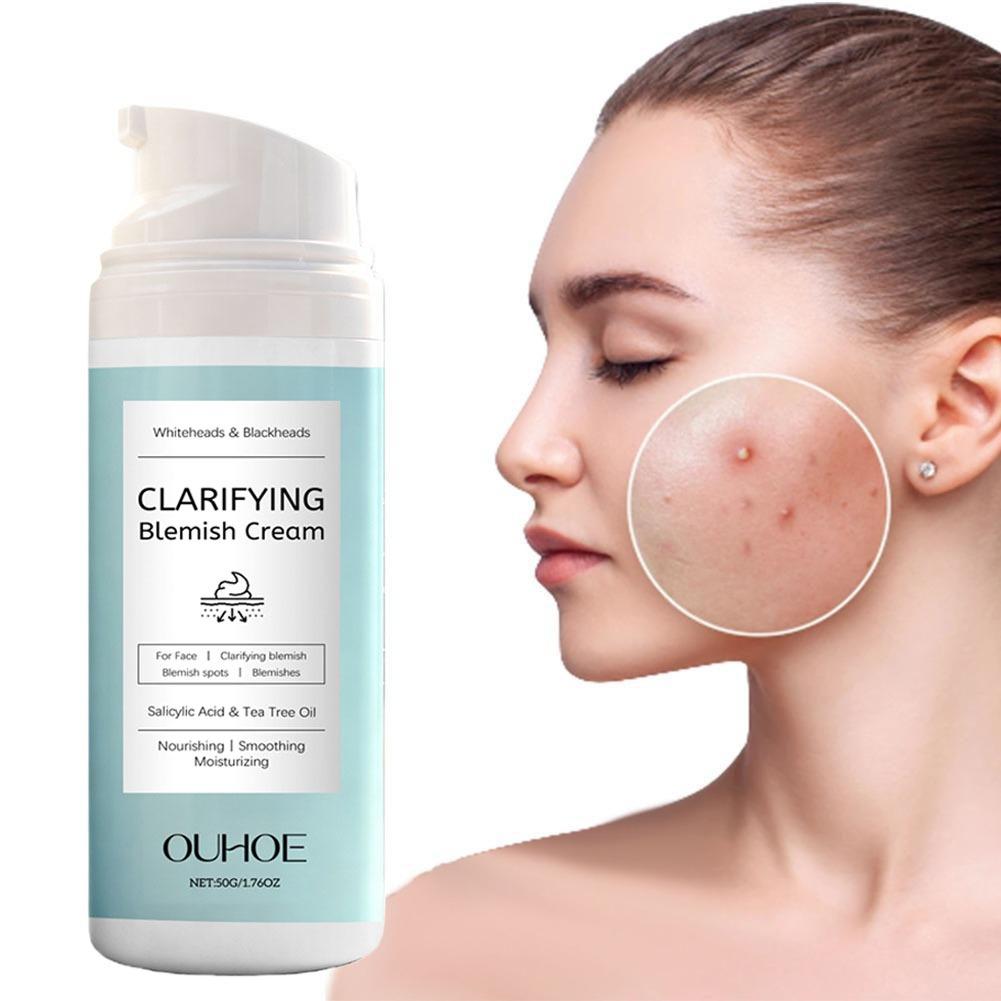 Azelaic Acid Cream - Krim Wajah Asam Salisilat untuk Kulit