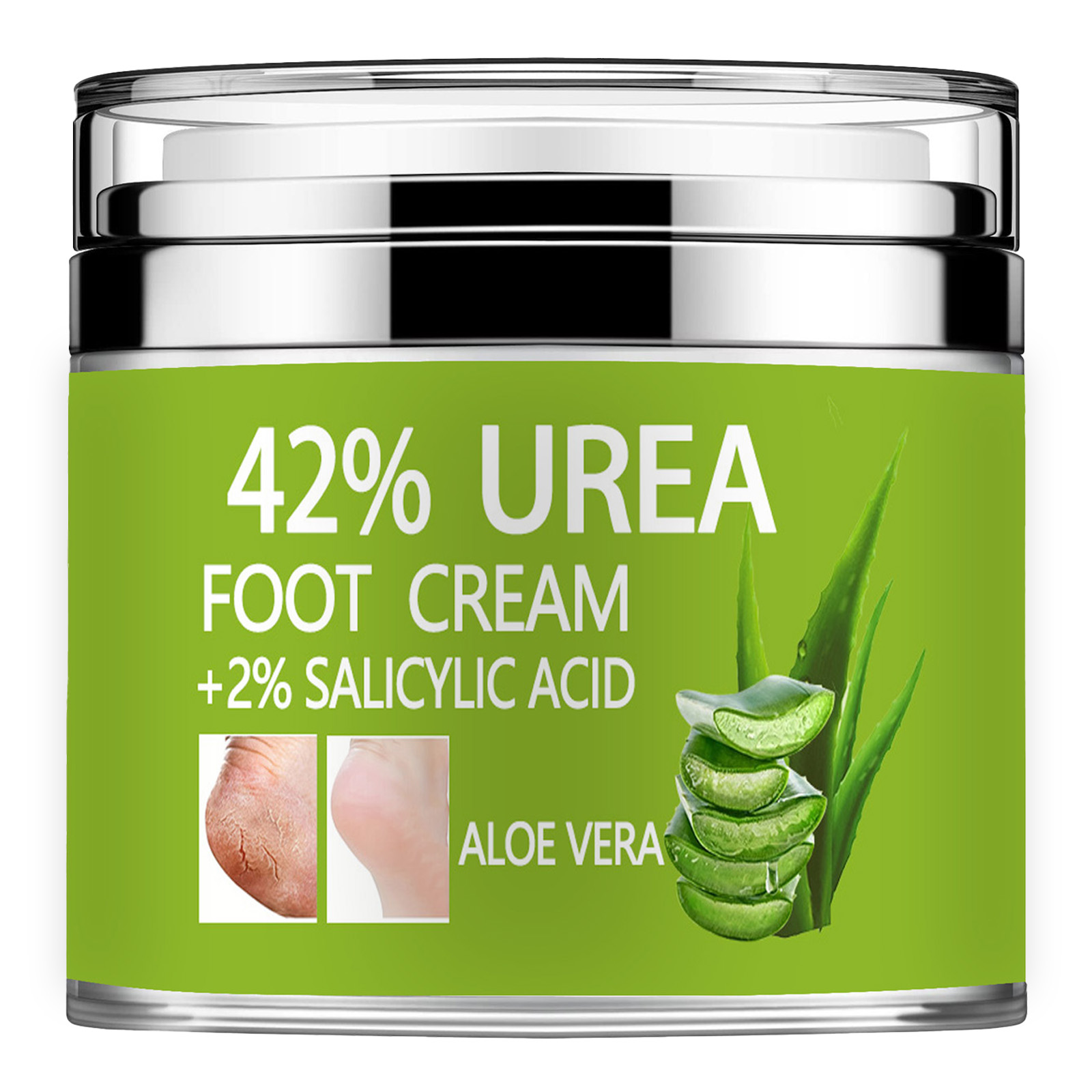 Azelaic Acid Cream - Krim Urea 42% Plus asam salisilat
