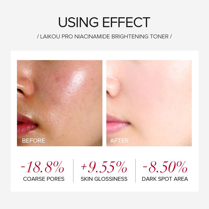 LAIKOU PRO Niacinamide 4Pcs Se - Niacinamide Brightening Serum ulasan dan harga