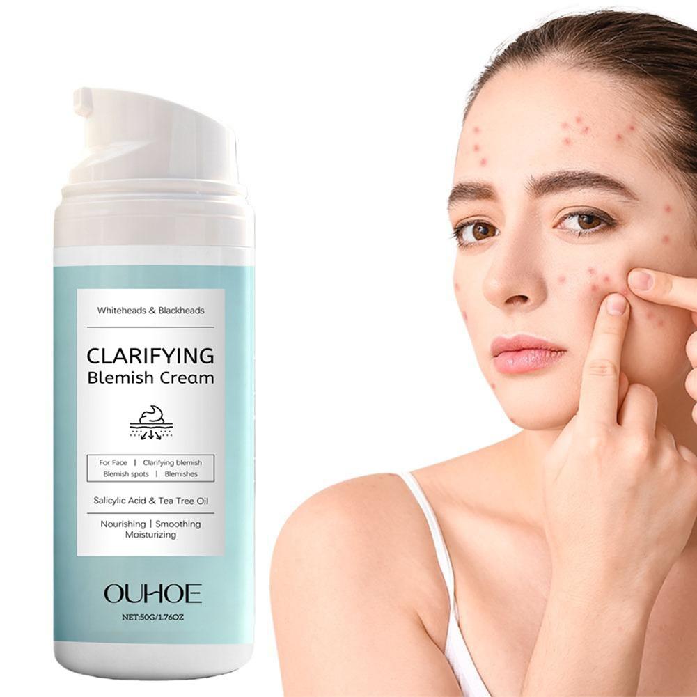 Krim Wajah Asam Salisilat untu - Azelaic Acid Cream ulasan dan harga
