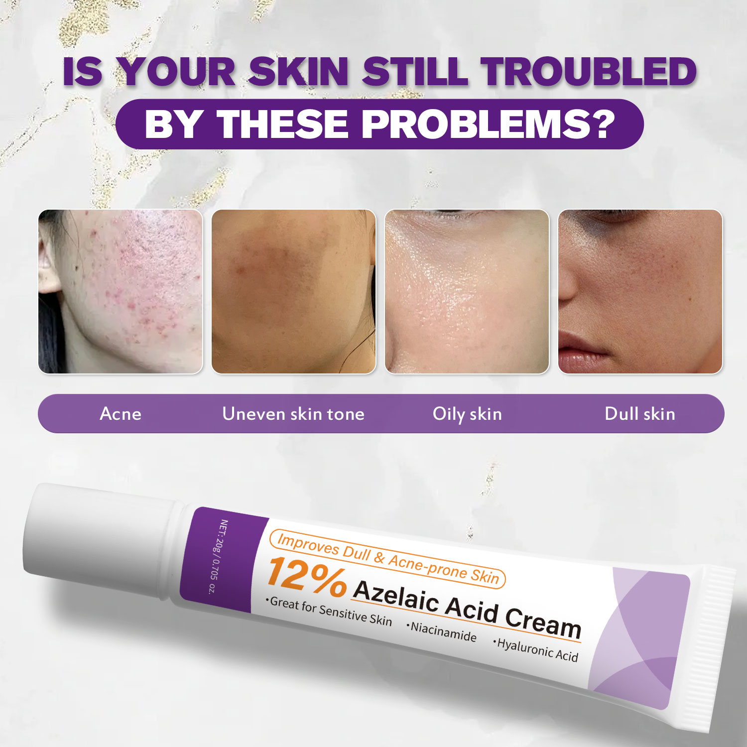 Krim Asam Azelaat Ringan Menin - Azelaic Acid Cream ulasan dan harga