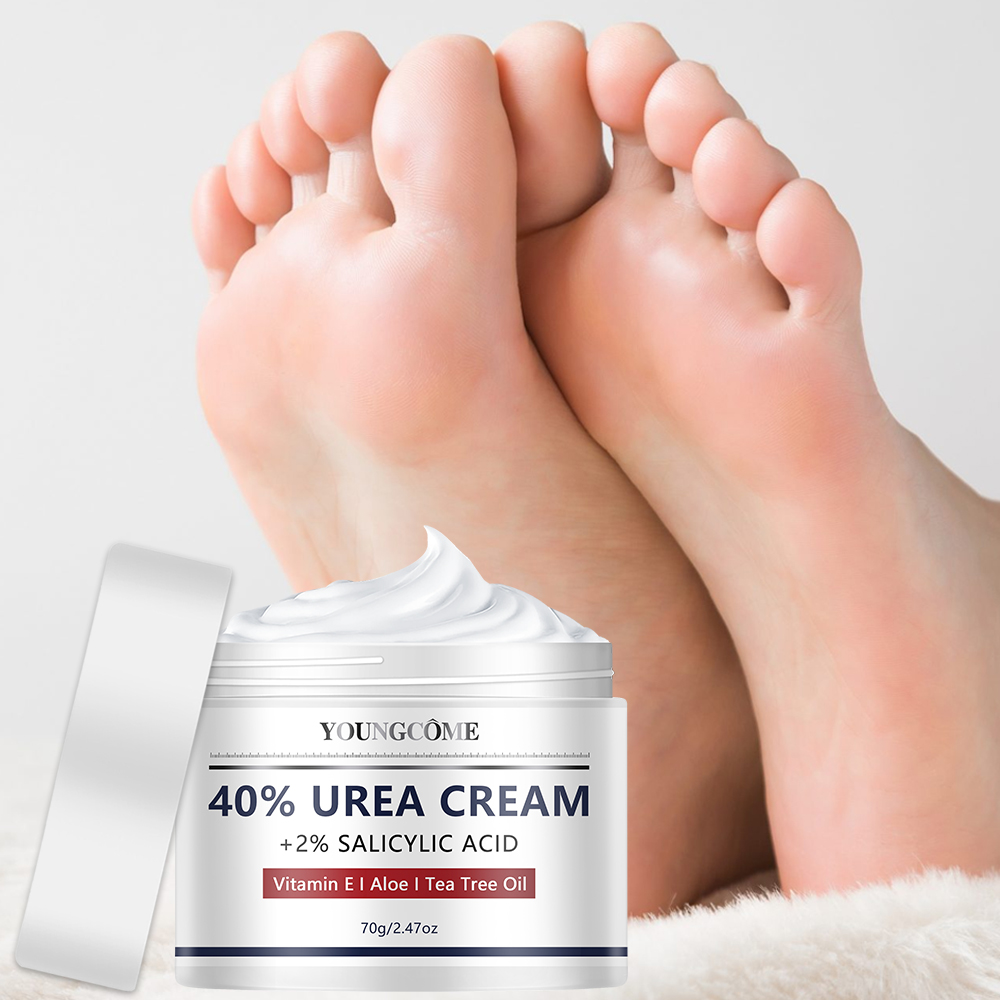 Krim Urea Perawatan Tangan dan - Azelaic Acid Cream ulasan dan harga